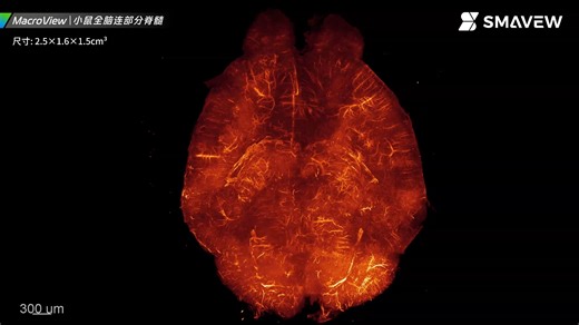慧观MacroView光片显微镜，厘米级大尺寸样本轻松成像！透明化小鼠全脑连部分脊髓。