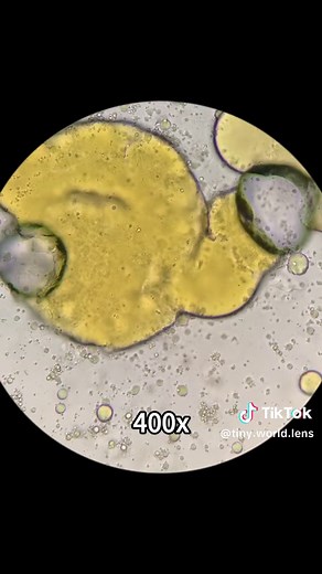 Exploring Instant Noodles Under a Microscope at 400x Magnification