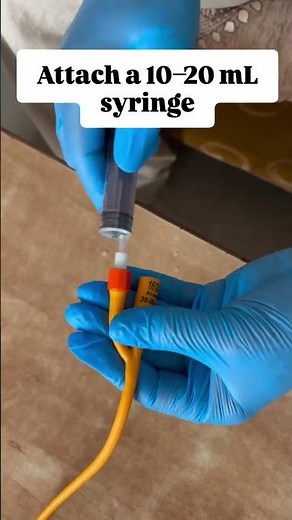 How to remove a foley catheter...