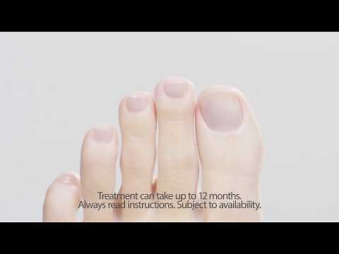 How to treat Nail fungal infections Nailner | #1 Nail Fungus Treatment | Easy To Use
