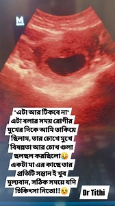 🔴Blighted Ovum (Anembryonic Pregnancy) A blighted ovum occurs when a fertilized egg implants in the uterus, forming a gestational sac, but the embryo fails to develop. It is an early pregnancy loss, usually detected on ultrasound. 🔹 Most commonly caused by chromosomal abnormalities 🔹 Not related to physical activity, stress, or food intake 🔹 Often presents with a positive pregnancy test but an empty sac on scan 🔹 Management depends on gestational age and clinical condition 👉 Importantly, a