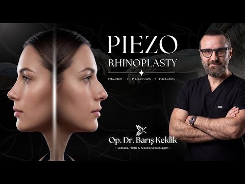 What is Piezo Ultrasonic Rhinoplasty? Its Advantages, Precision and Recovery Process