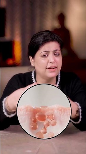 Blackheads vs Clogged Pores | Dermatologist Explains Real Causes