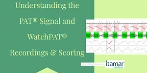 Understanding the PAT® Signal and WatchPAT® Recordings & Scoring