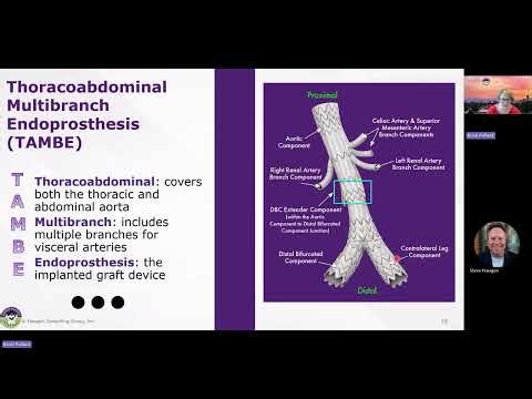HCGTV: Webinar Snippet - Thoracoabdominal Multibranch Endoprosthesis (TAMBE)