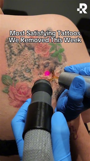 Satisfying Tattoo Removals 😍 #removery