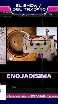 Why do you SEE cones in Bitcoin (scientific explanation) 🧠