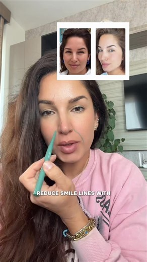 Hazal | Certified Face Yoga Coach on Instagram: "Smile lines don’t come from smiling — they come from tension, volume loss, and poor circulation. When you release the tension and restore flow, the face softens naturally — no needles, no fillers. On 12th January, I’m starting my Face Lift WhatsApp Program, where we target all facial concerns step by step: • smile lines • jawline, chin • cheeks • eyes • puffiness Only 6 days left. If you’re ready for real change, comment “YES” and I’ll send you th