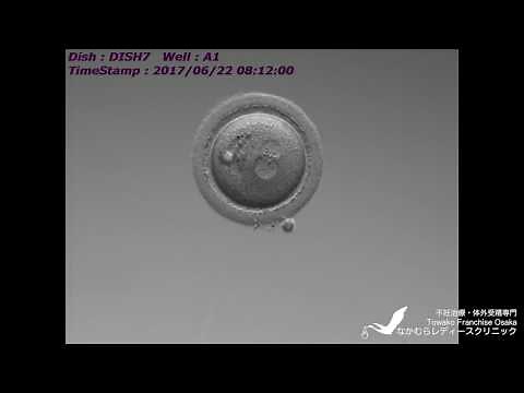 胚発育のタイムラプス観察(ICSI後〜胚盤胞)