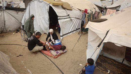 Up to 46,000 injuries in Gaza require reconstructive surgery: Study