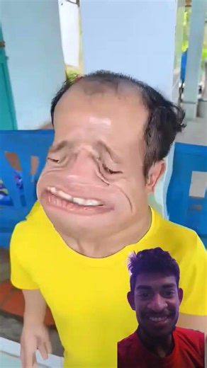 The pain 🤕🤥 #youtubeshorts #comedy #subscribe #comedy #likeandsubscribe