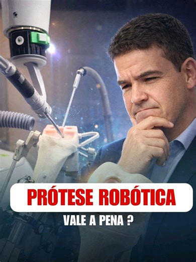 Será que a prótese robótica é melhor do que a tradicional? Essa é uma dúvida muito comum entre pacientes que precisam de cirurgia no joelho. A tecnologia robótica trouxe avanços importantes, principalmente no planejamento e na execução do procedimento. Com o uso de softwares antes mesmo da cirurgia, é possível retirar menos osso, preservar melhor os ligamentos e reduzir o risco de erros técnicos. Isso significa uma prótese mais bem ajustada, respeitando o equilíbrio do joelho tanto em movimento 
