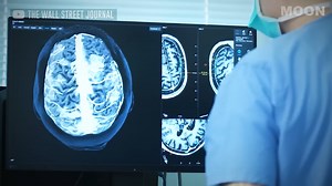 The Dark Truth About Neuralink and Brain Chips