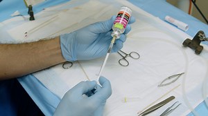 Author Spotlight: Insights into the Effect of Ischemia Reperfusion on Lung Transplantation