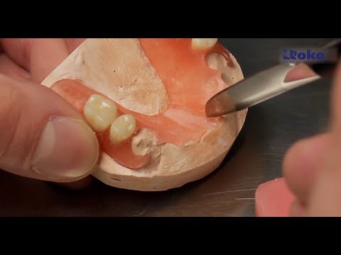 Thermoplastic dentures - Repair and service