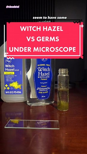 Witch Hazel Effectiveness Against Germs Under Microscope