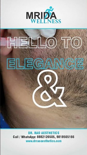 Enhance Your Jawline with Botox for Masseter Muscle | Facial Slimming & Jaw Contouring