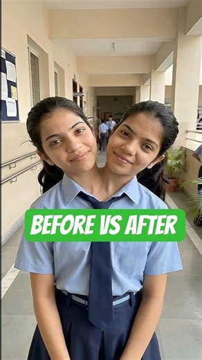 before vs after girl's