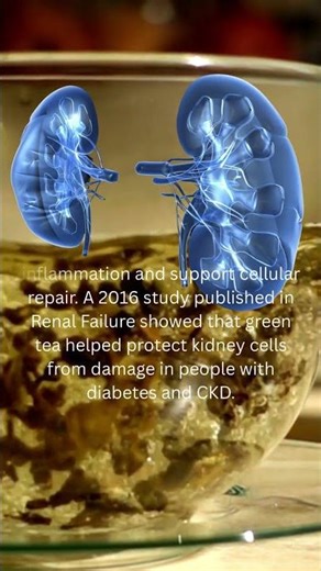 Green Tea Is One Of The Most Kidney Supportive Drinks You Can Choose