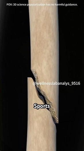 How tibia fractures surgery is performed(3D Animation) #doctor #3danimation