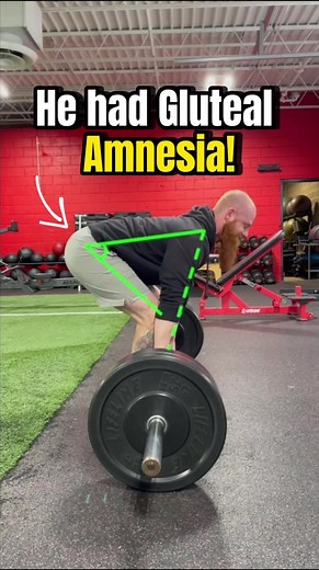 Understanding Gluteal Amnesia and How to Fix It
