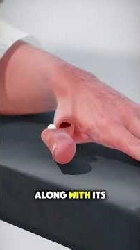 How Toe-to-Hand Transfer Surgery Is Performed | surgery Explained #orthopedicsurgery