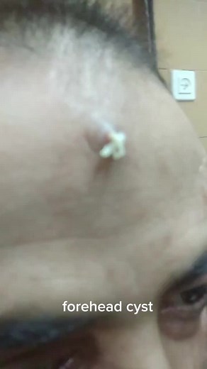 Corrin Yatom ב-TikTok