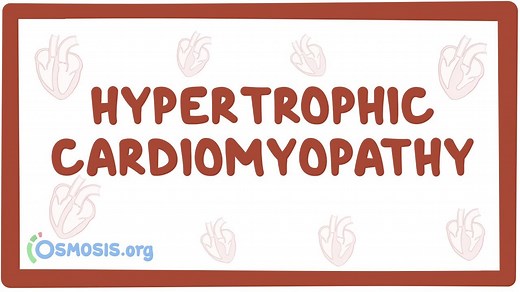 Hypertrophic cardiomyopathy: Video, Causes, & Meaning | Osmosis