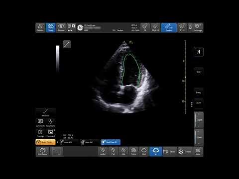 Venue™ Family R3 Tutorial - Real-Time EF
