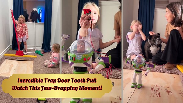 Watch This Incredible Trap Door Tooth Pull in Action