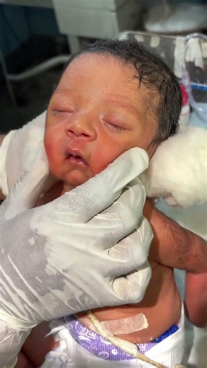 Newborn baby cute beautiful 😊👍 #youtubeshorts #anmnursing #viralvideo #shortvideo #sacribe #viral