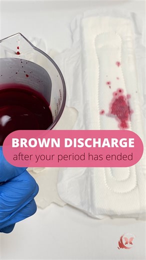 16K views · 26 reactions | Is it normal to have brown discharge after your period has ended? Absolutely YES! | Dr.Gynae | Facebook