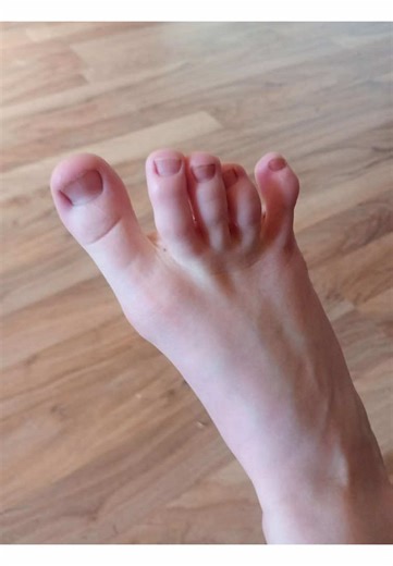 no thats not my feet in the cover