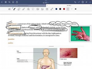 GI - Physical Examination part 1