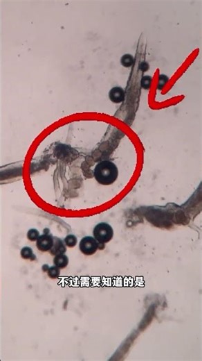 网友要看的，大蒜的杀菌靠的不是它的味道#显微镜下的世界 #microscope #百科密码 #健康 #science #微观世界 #科普