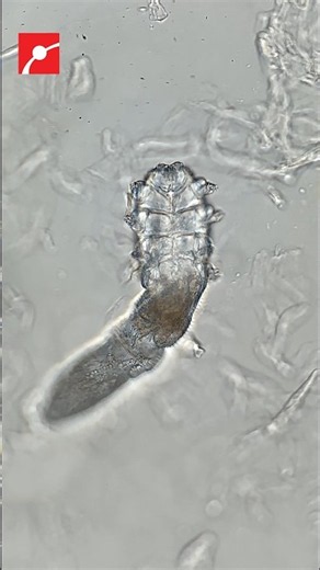 Face Mites Under the Microscope!