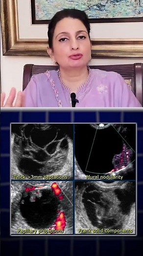 Complex vs. Simple Ovarian Cysts: Differences & Complications Explained | Dr. Shamayela Hanif