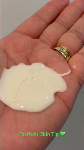 My Psoriasis Skin-Saver: Sebamed 10% Urea 💚✨