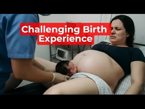 A Mother Faced Extreme Difficulty | Challenging Delivery in History | Baby Boy 3800g