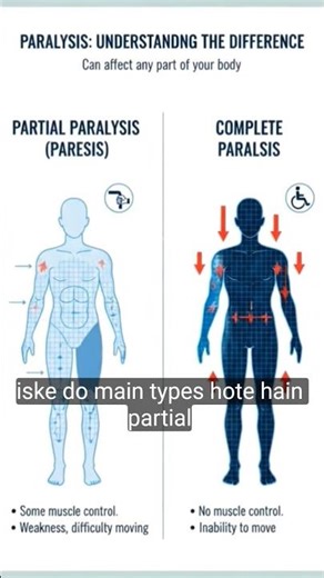 What is paralysis and types of paralysis #knowledge #education