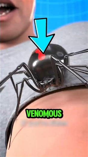 Bitten by a Venomous Spider NEVER Do This!