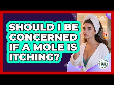 Should I Be Concerned If A Mole Is Itching?