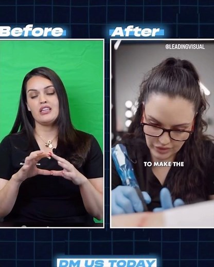 ✨ Best Thigh Lift Scar Transformation