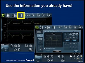 Schreiber - Airway Pressure Release Ventilation