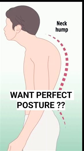 Fix Hunchback Posture Naturally ✅ #hunchbackfix #posturecorrection #backexercise #shortsfeed #shorts