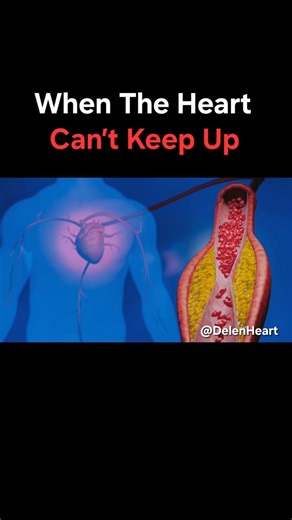 ✨️When the Heart Can’t Keep Up.