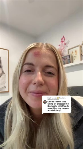 Effective Scabies Removal Techniques for Humans