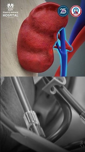 Kidney Transplant: Everything You Need to Know | Dr. Kedar Suthar