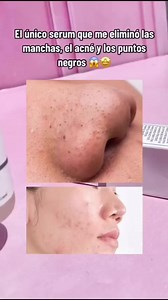 862K views · 4.9K reactions | Lo mejor para tu skincare 凉❤️ | Care Beauty | Facebook