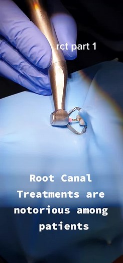 #dental#abscess #toothabscess #dentalschool #dentalstudent #dentista #rootcanaltreatment#rct#protaper#apexlocator